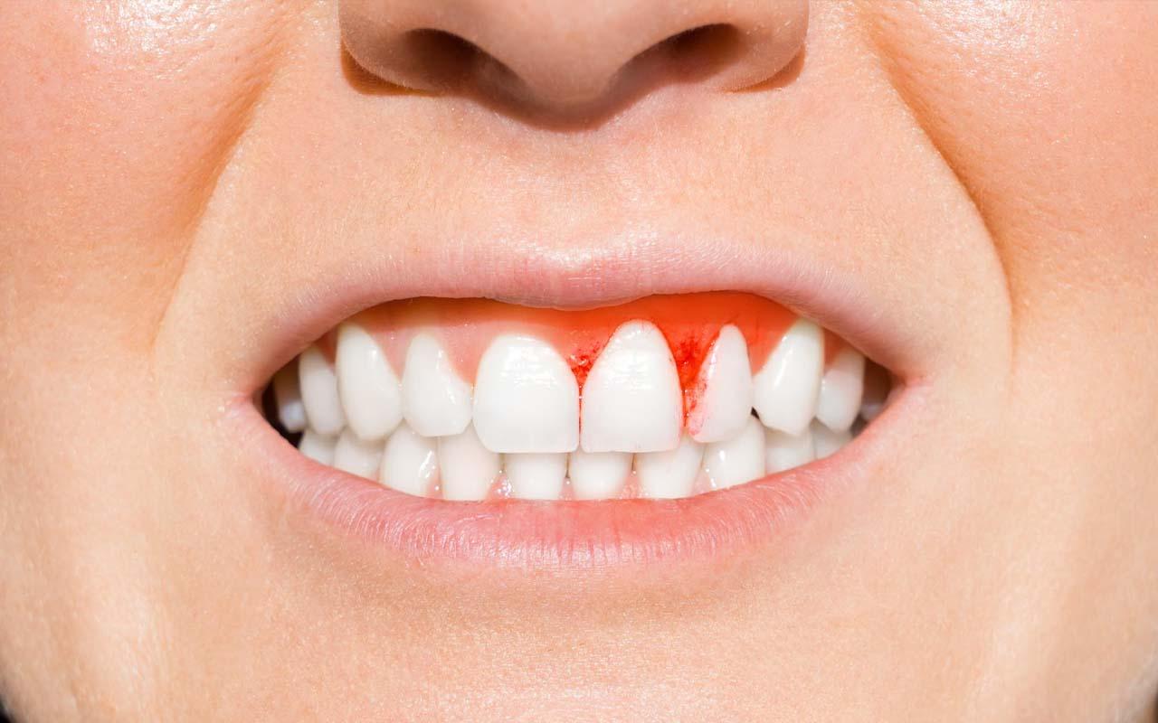 A precise daily routine electric toothbrush technique interdental brushes tongue care and water flossing